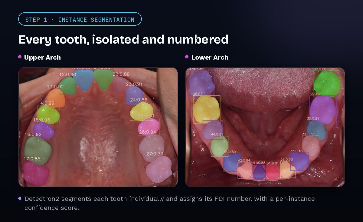 Dental AI: Segmentation & Detection Solutions — conversation flow mockup
