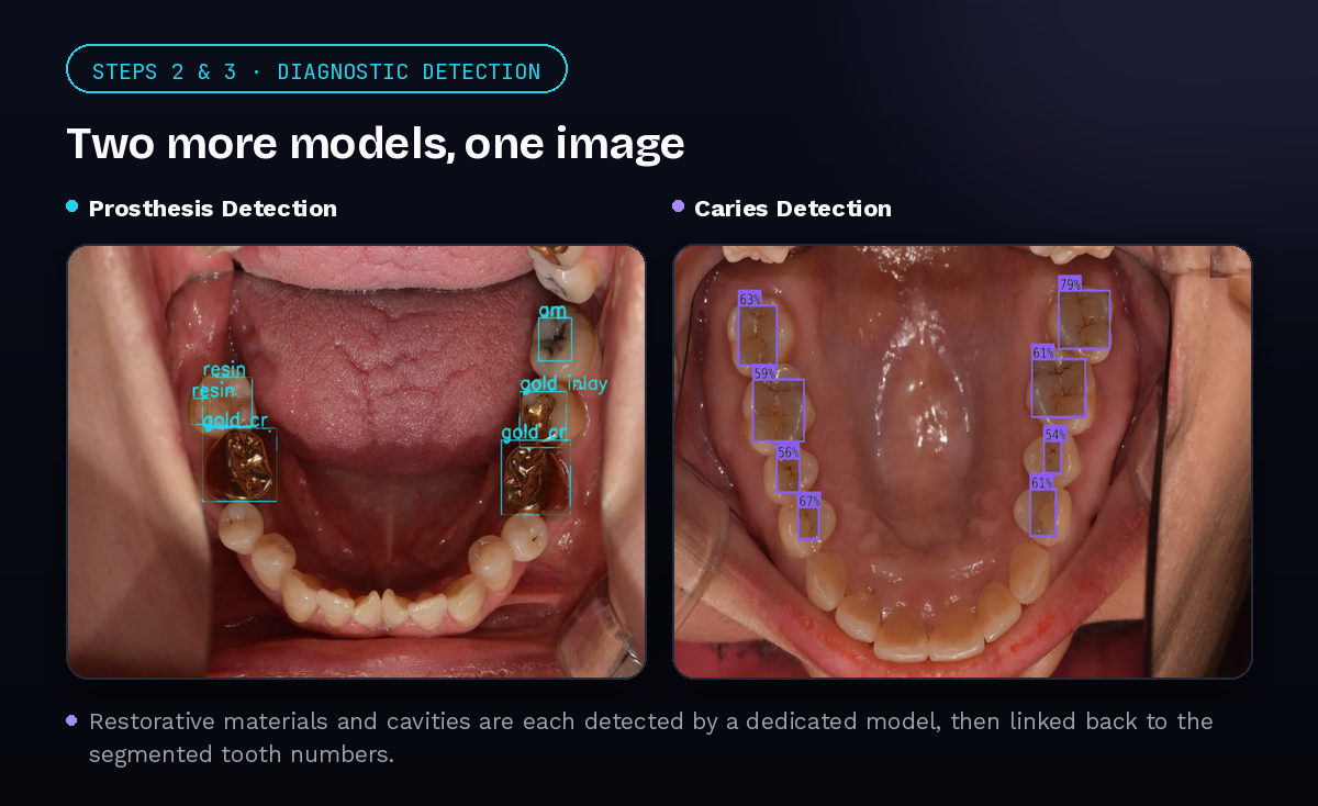 Dental AI: Segmentation & Detection Solutions — analytics dashboard mockup